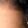 Burmese Curly Lace Frontal