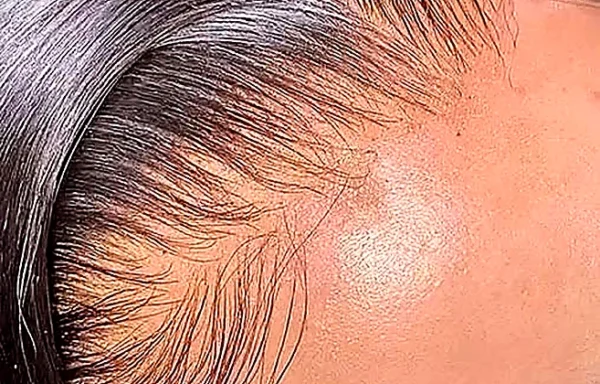 silky_straight_frontal_-_2_enhanced Silky Straight Lace Frontal